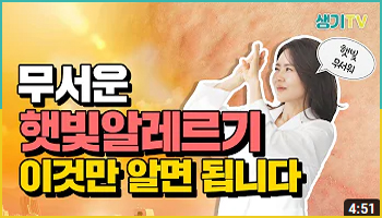 무서운 햇빛알레르기 이것만 알면 됩니다